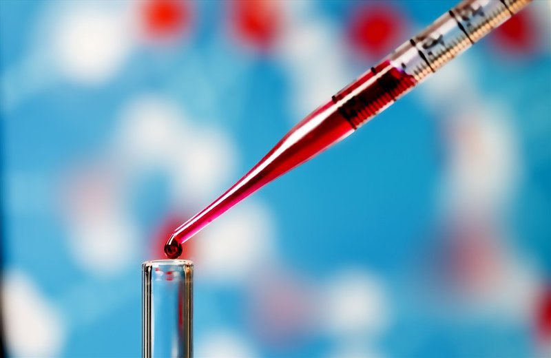 y học việt nam Ghép thành công tế bào gốc tạo máu
